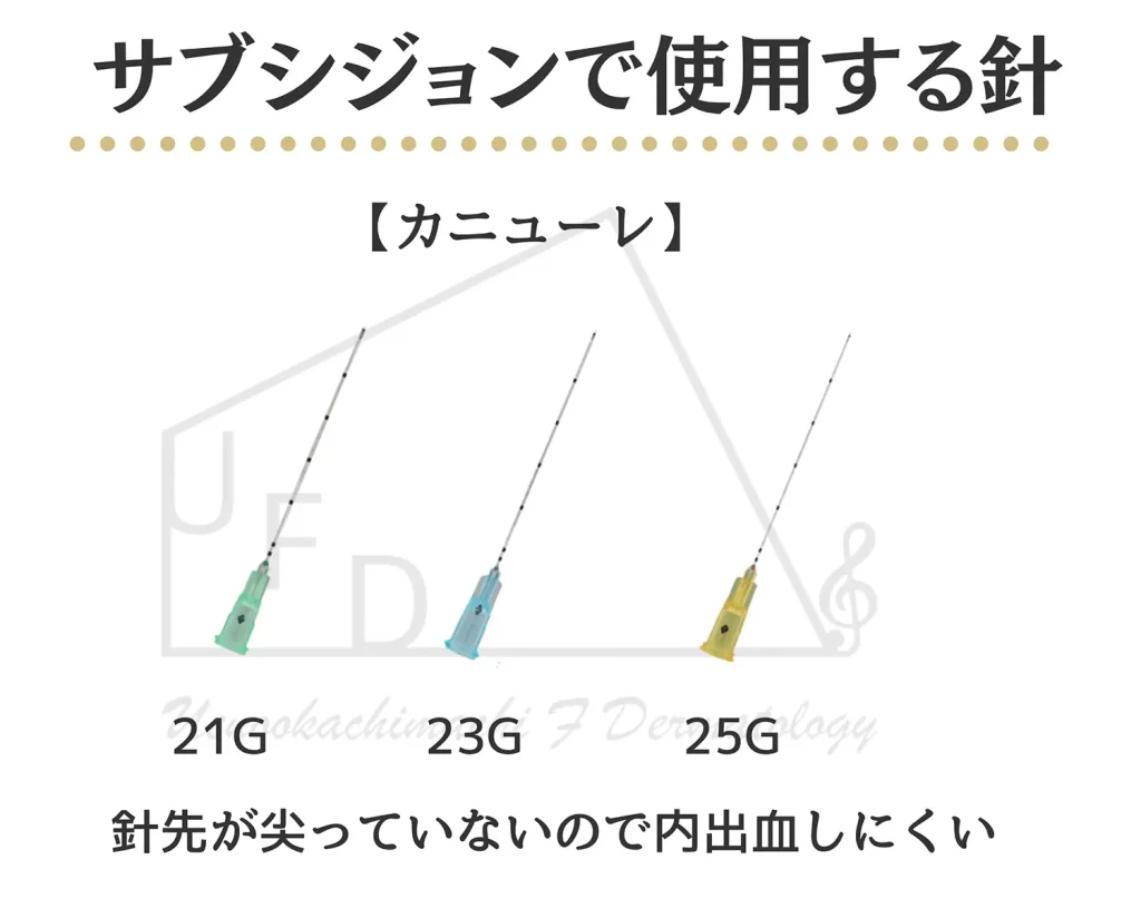 サブシジョンで使用する針