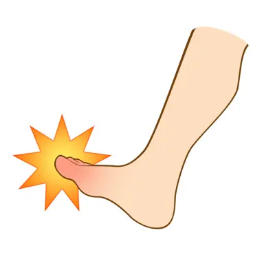 外傷や圧力のイラスト