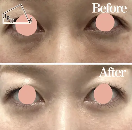 症例2 【40歳代女性】