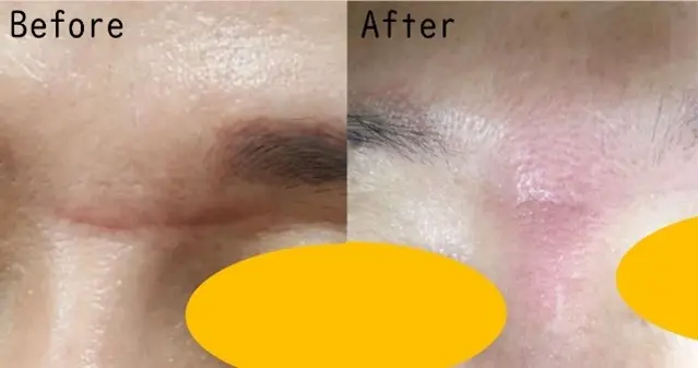 ジュベルックの症例3