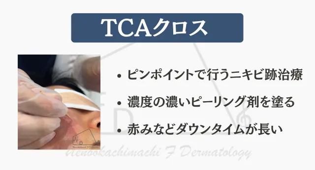 TCAの画像