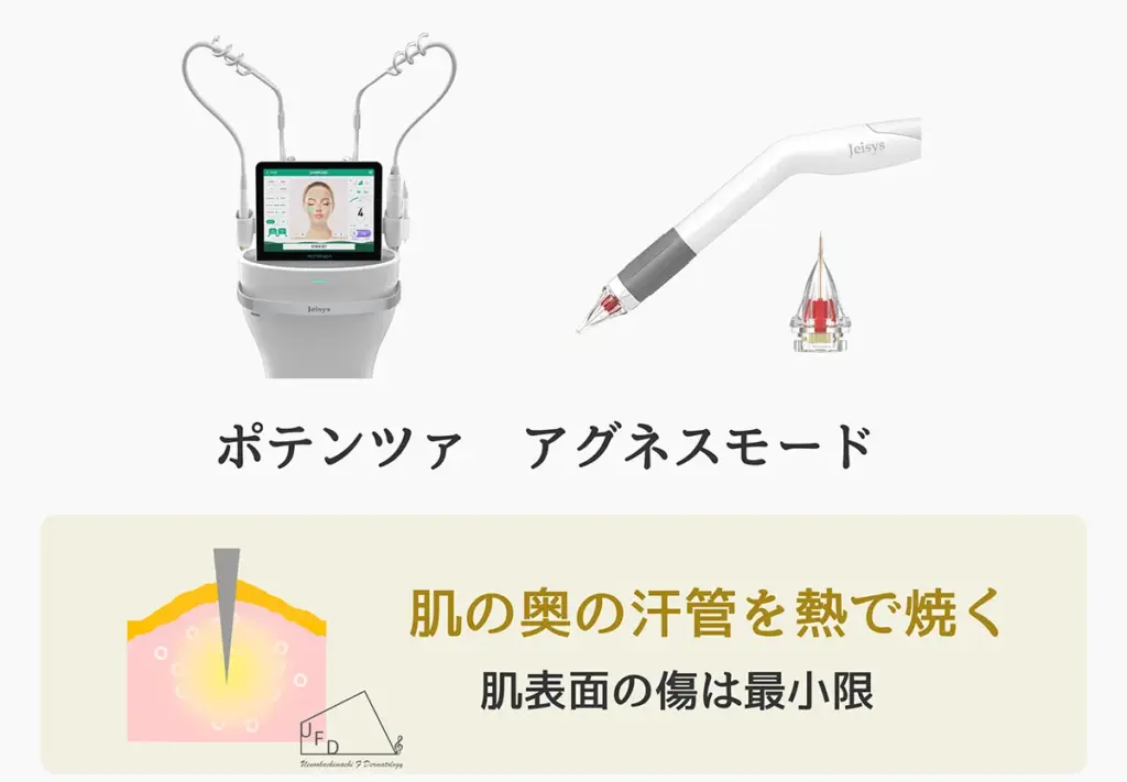 ポテンツァアグネスモード