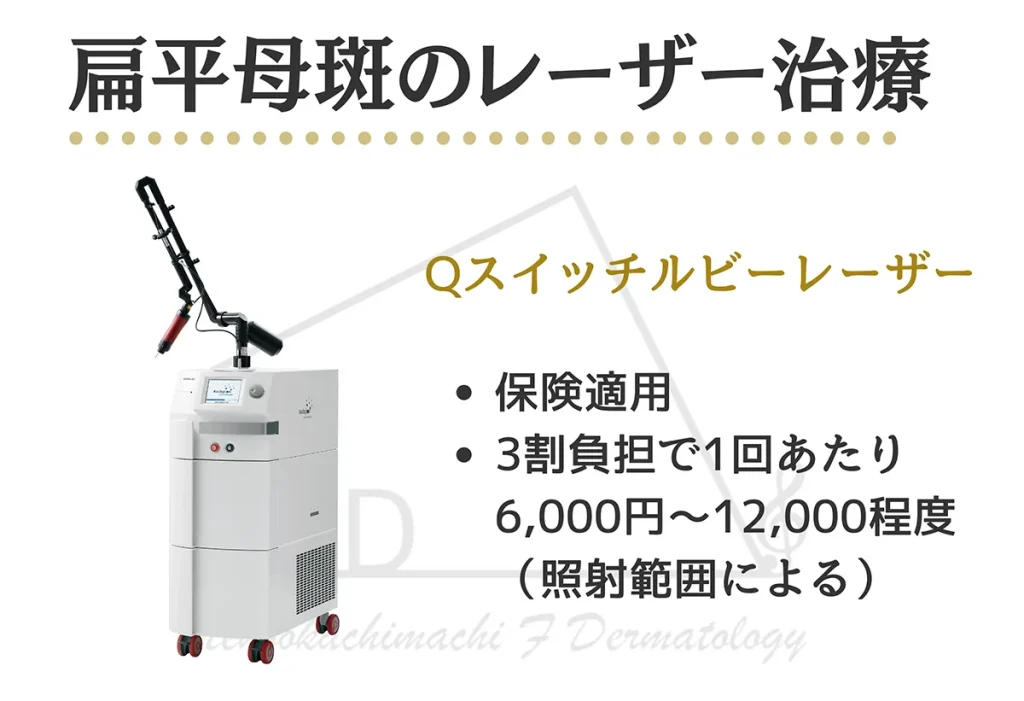 扁平母斑のレーザー治療