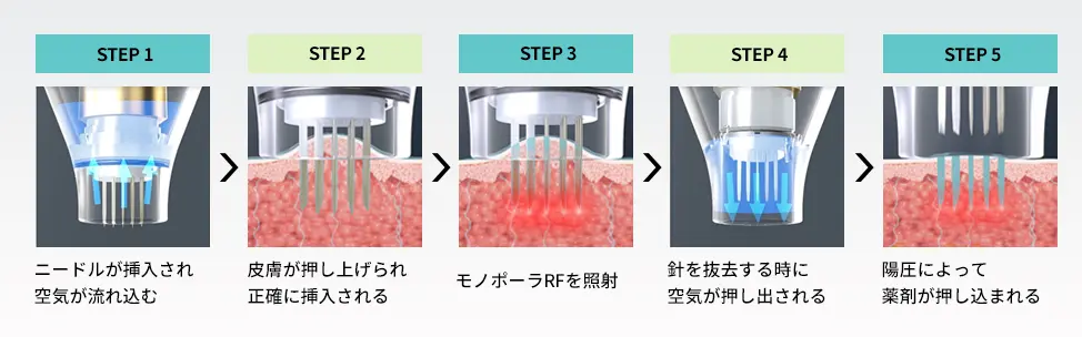 ポテンツァイメージ