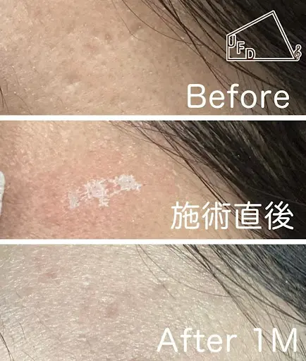 TCAクロスの当院での症例