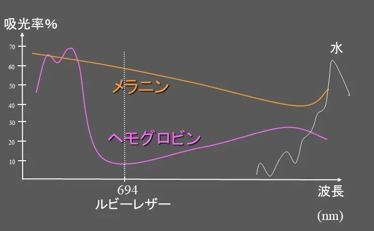Qスイッチルビーレーザーについて
