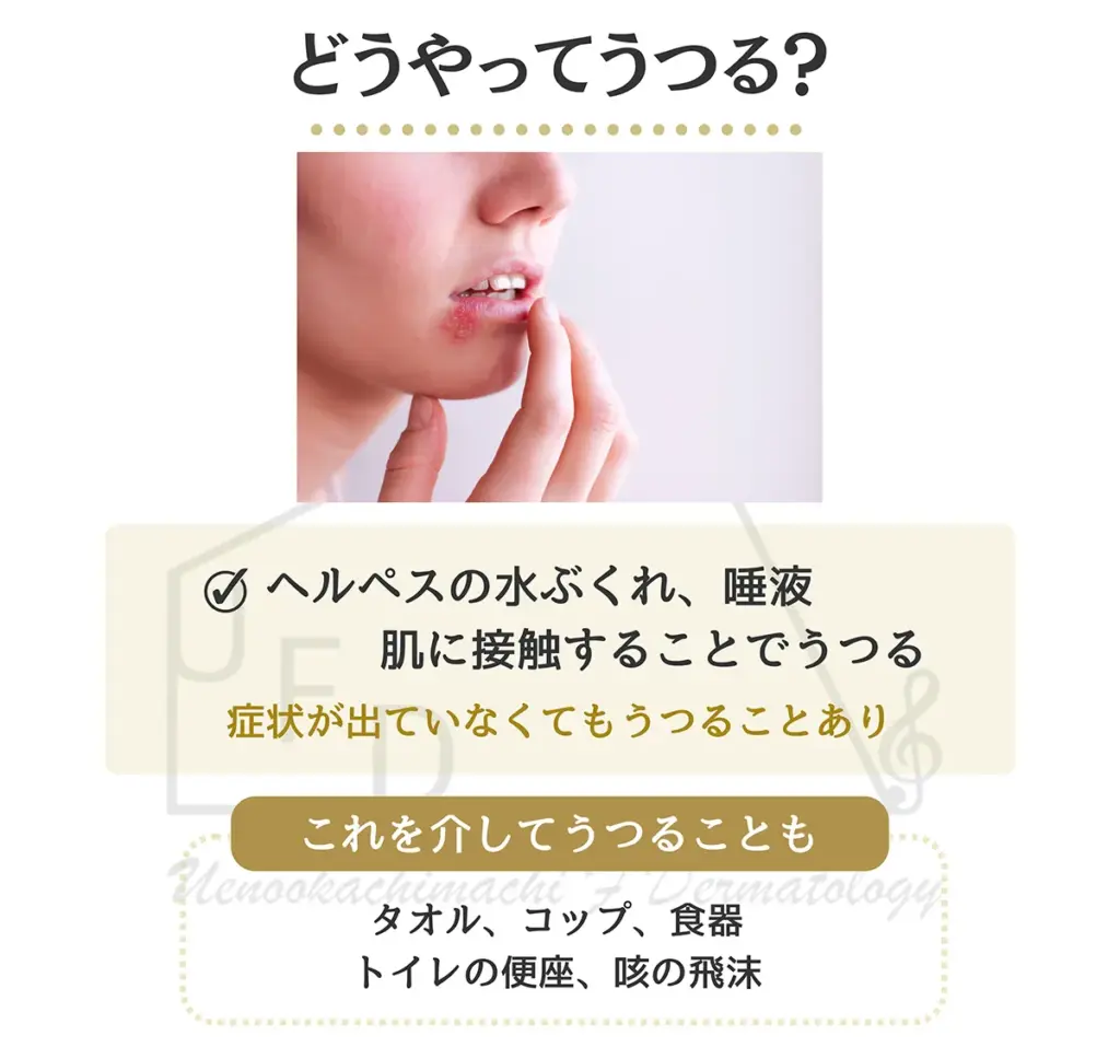 ヘルペスの感染経路