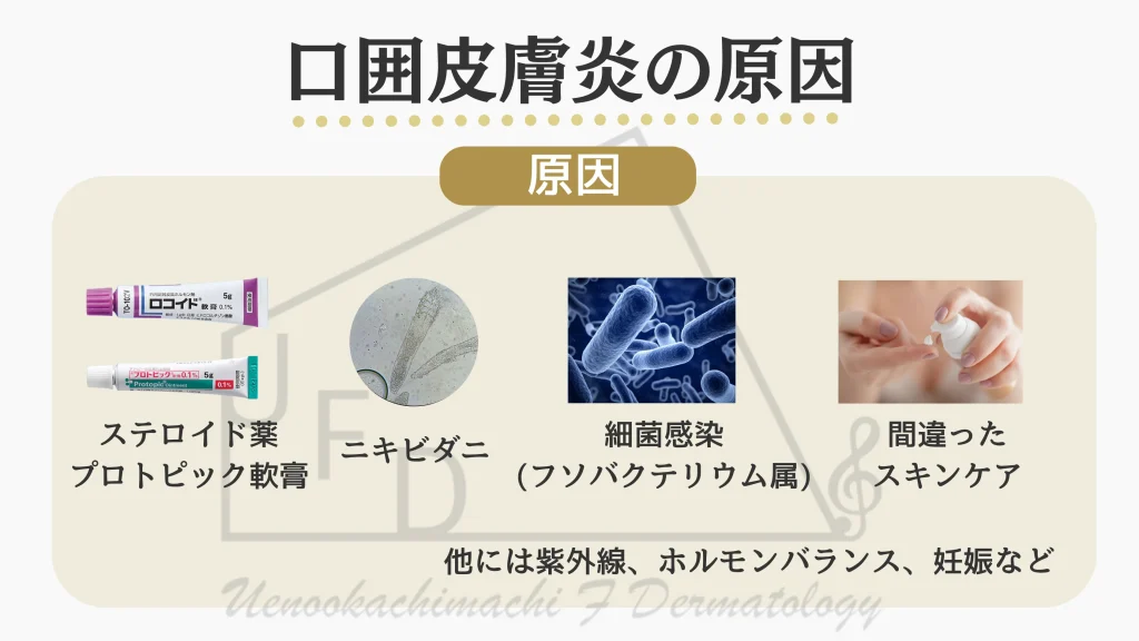 口囲皮膚炎が発症する原因について解説