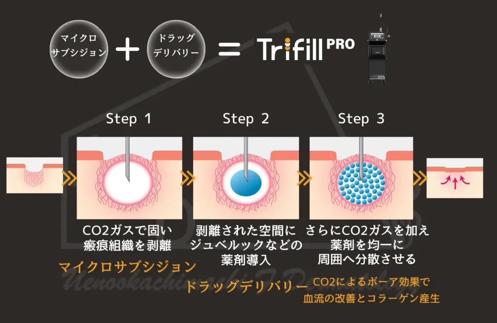 トライフィルプロの特徴