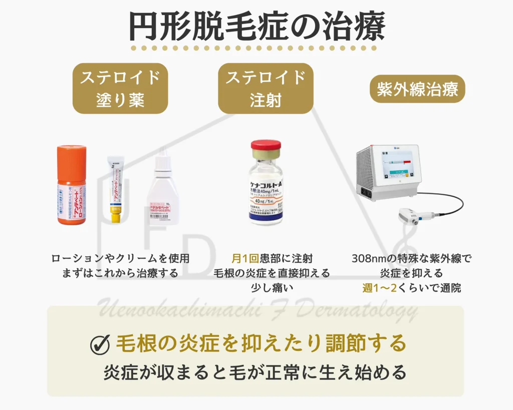 円形脱毛症の治療方法について画像付きで詳しく解説