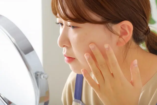 【皮膚科専門医監修】シミ・そばかすを消す方法とは?症状ごとの治療法を紹介