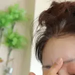 シワ治療・シワ取り|おでこのシワ、目の下のシワなど皮膚科の治療を解説