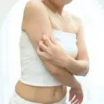 アトピーの画像