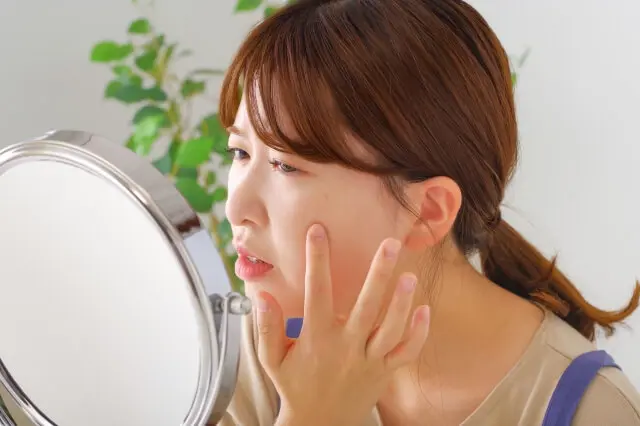 汗管腫とは？原因から治療法・保険適用の有無まで徹底解説