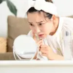 イソトレチノインでニキビ改善!治療効果と副作用、注意点を徹底解説