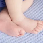 扁平母斑(へんぺいぼはん)とは?原因から治療・保険適用まで徹底解説