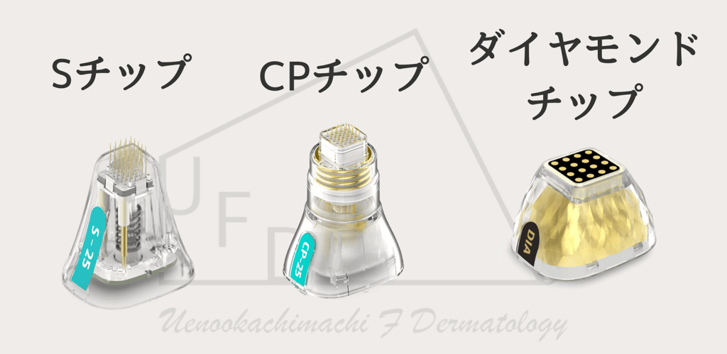 ポテンツァで使用するチップについて画像付きで徹底解説します 使用するチップはSチップ CPチップ ダイヤモンドチップ それぞれ照射できる種類と得意な症状で使い分けます