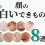 顔の白いイボの正体は?原因・種類・見分け方と治療法を皮膚科専門医が徹底解説【脂漏性角化症・稗粒腫・汗管腫など】