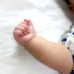 蒙古斑は消えない？レーザー治療が必要なの？異所性蒙古斑との違いと治療方法を解説