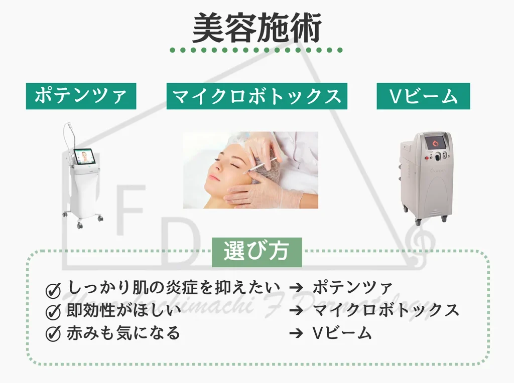 しっかり治したい方には美容施術 ポテンツァ マイクロボトックス Vビームについて解説
