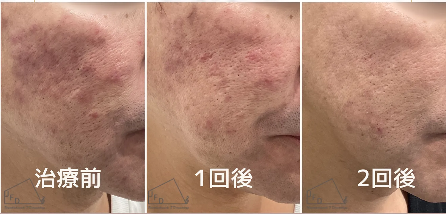 当院の治療症例についてご紹介 症例1