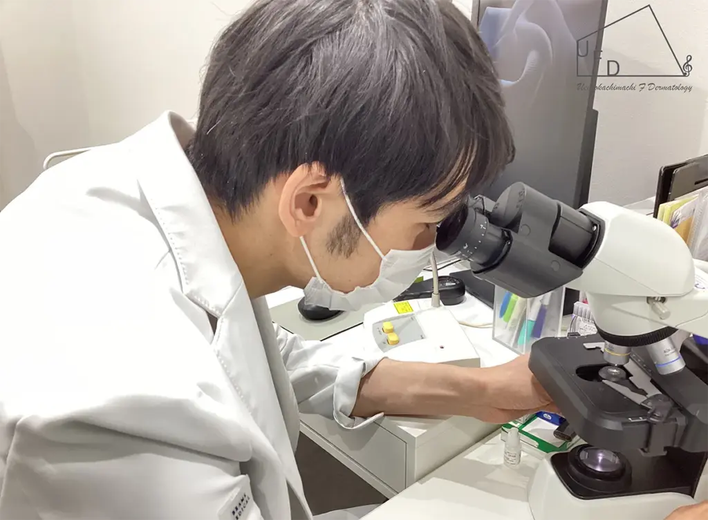 水虫（白癬）の検査