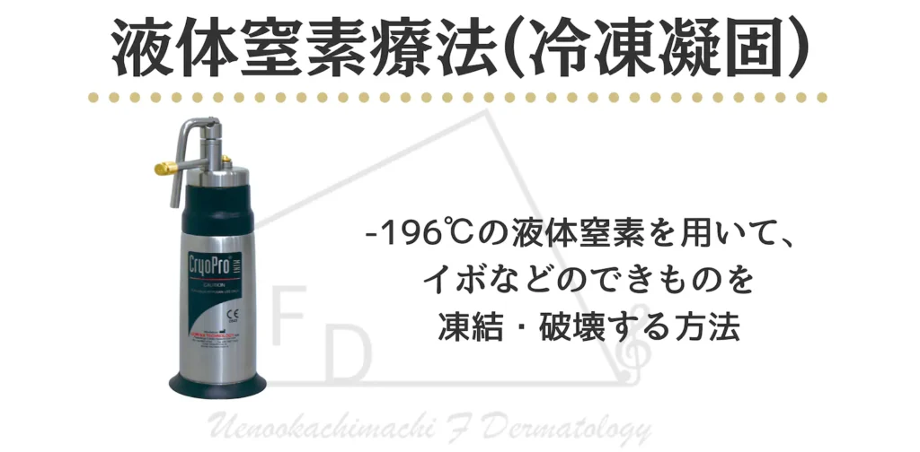 液体窒素療法　冷凍凝固による治療