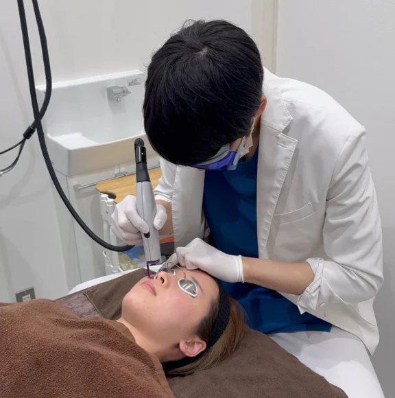 Vビームを照射している様子