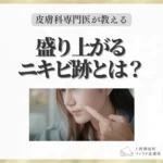 コラム 盛り上がるニキビ跡とは?しこり・ケロイド・肥厚性瘢痕の違いと皮膚科での治療法のサムネイル画像